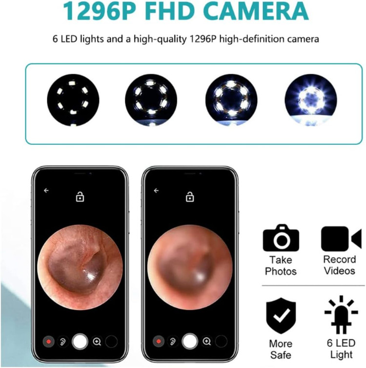 گوش پاک کن با قطر 3.9 میلی متر، وای فای HD 1080P، اتوسکوپ، آندوسکوپ، قاشق گوش، پاک کننده جرم گوش، اتوسکوپ با پورت USB، قاشق حذف جرم قابل مشاهده وای فای (مشکی + نسخه استاندارد) ن1