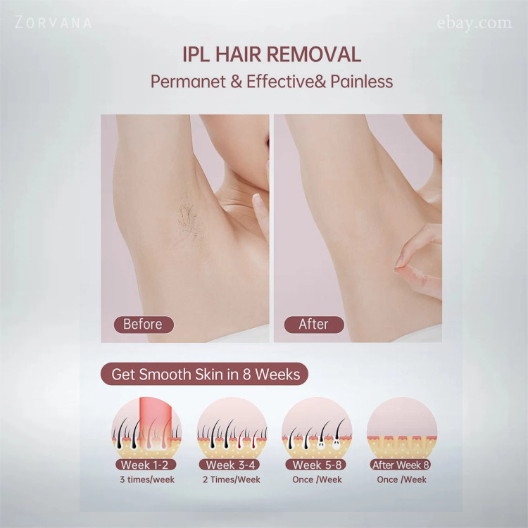 لیزر رفع موهای زائد IPL مجهز به سیستم خنککننده، ۹۹۹,۹۰۰ شات | ایمن، ملایم و دائمی