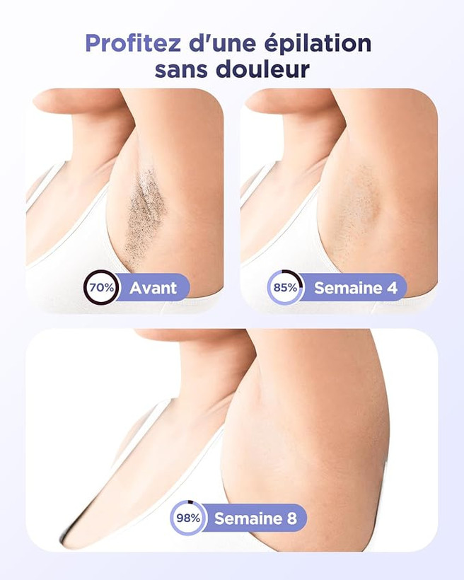 دستگاه حذف موهای زائد لیزری - دستگاه اپیلاتور نوری (IPL) Haarlosy با قابلیت خنککنندگی و ۹۹۹,۹۰۰ فلش؛ دارای عملکرد ۳ در ۱ (رفع موهای زائد، جوانسازی پوست و رفع آکنه) و ۲ حالت کاری، مناسب برای رفع دائمی موهای زائد زیر بغل، ناحیه تناسلی و سایر نقاط بدن.